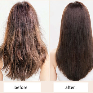 Suero de Aceite Natural de Romero y Cebolla Anticaída, Nutre los Folículos y Estimula el Crecimiento del Cabello, 30 ml, Apto para Cabello Fino - Product Image 5