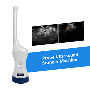 Meest verkochte draadloze kleuren <span class=keywords><strong>Doppler</strong></span> echografiemachine met lineaire en rectale probe voor ziekenhuizen en klinieken - Product Image 6
