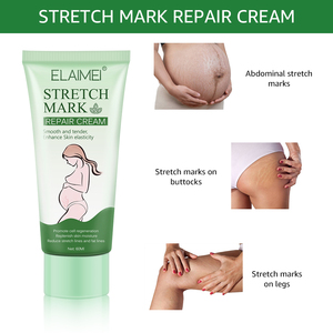 Logo personnalisé meilleure crème de massage anti-<span class=keywords><strong>vergeture</strong></span> coréenne efficace pour la grossesse crème anti-vergetures pour le corps - Product Image 3