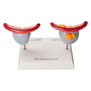 Modelo Anatómico Patológico de Próstata Humana para Enseñanza y Formación Médica, Material de PVC, Modelo Anatómico para Educación Científica - Product Image 5