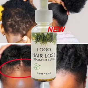 Özel özel etiket 100% doğal organik saç derisi bakımı Serum saç tedavisi büyüme kadınlar için biberiye özü yağı