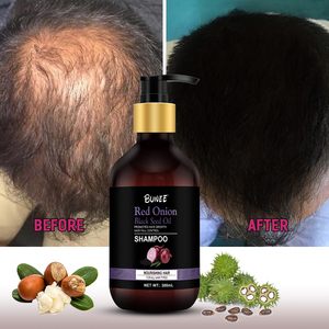 Produits populaires Herbal Hair Essences Shampooing Red Oignon Black Seed Oil Growth Shampooing et après-shampooing avec Factory Outlet - Product Image 2