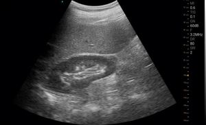 Wifi xách tay 128 yếu tố Mano không dây DOPPLER máy tính xách tay siêu âm đầu dò - Product Image 6