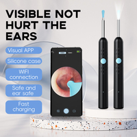 Nettoyeur d'oreilles sans fil portable avec caméra 5MP, visibilité intelligente, Wi-Fi sécurisé, batterie 230 mAh, 45 minutes d'autonomie, gyroscope 3 axes, CE/FCC