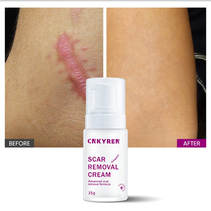 <span class=keywords><strong>ครีม</strong></span>บำรุงผิวหน้าต่อต้านริ้วรอยด้วยกรดไฮยาลูโรนิก เชียบัตเตอร์ และกรดแลคโตไบโอนิก สำหรับ<span class=keywords><strong>ลด</strong></span><span class=keywords><strong>รอย</strong></span>แผลเป็นจาก<span class=keywords><strong>สิว</strong></span>และ<span class=keywords><strong>รอย</strong></span>แตกลาย - Product Image 1