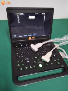Mesin USG Digital Portabel SUN-800C untuk Kehamilan, Rumah Sakit, dan Ekokardiografi - Product Image 5