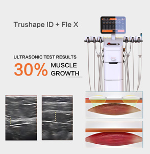 Máquina Multifuncional TruShape ID Flex para Esculpir el Cuerpo, Entrenamiento Muscular, Quema de Grasa, Masajeador de Cuello y Hombros - Product Image 5
