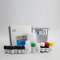 Kit de Test Elisa pour détection de la grossesse, appareil de détection rapide de très bonne qualité, fièvre Ab