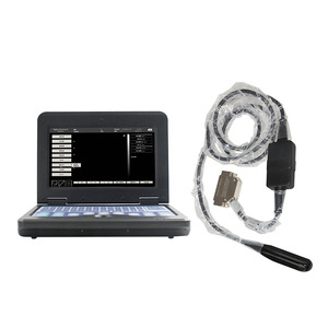 Équipement de diagnostic d'échographie vétérinaire Tikopie en mode B pour la surveillance cardiaque fœtale, appareil d'échographie portable en mode B - Product Image 4