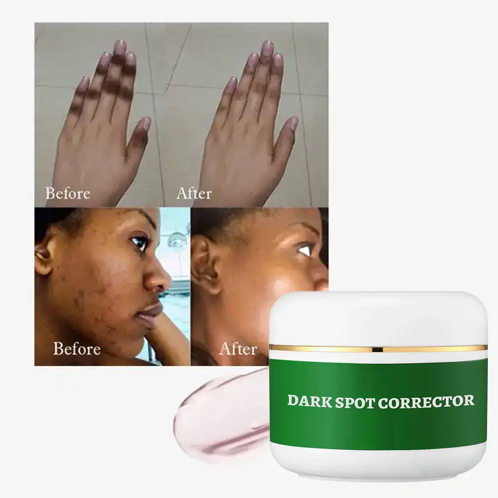 Mạnh mẽ Remover 7 ngày Dark Spot Kem Corrector chăm sóc da nhãn hiệu riêng làm trắng tàn nhang Mặt Kem Lotion