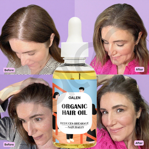 Aceite orgánico para el cuidado del cabello, 30ml, tratamiento de cuero cabelludo a base de hierbas naturales para un rápido crecimiento del cabello, anticaspa <span class=keywords><strong>y</strong></span> reparación de la pérdida de cabello - Product Image 2