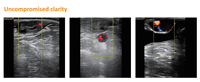 BestScan S10 Plateforme d'échographie vétérinaire couleur Doppler sans fil IA haut de gamme, évolutible, pour bovins et équidés