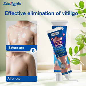 ZouRunAn krim penghilang Vitiligo, perawatan pigmentasi untuk kerusakan matahari, mengurangi noda & pengencangan warna kulit, perbaikan mendalam - Product Image 4