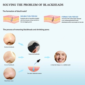 Siyah nokta kaldır maske Peel burun bandı 10 parça/kutu kafa kaldır çıkartmalar cilt bakımı maskesi yama derin temizlik gözenek burun siyah - Product Image 5