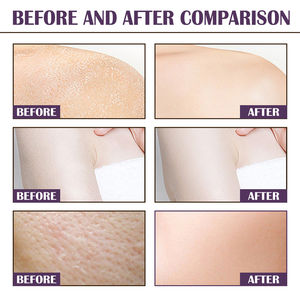 EELHOE 60g Gommage corporel à la niacinamide et à la mûre, hydratant, éclaircissant, adoucissant, lissant, exfoliant, nettoyant les impuretés - Product Image 4