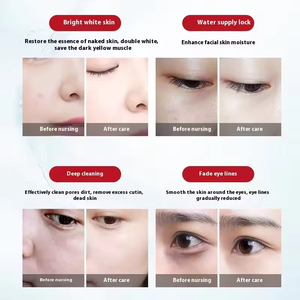 เครื่องดูแลผิวหน้าแบบครบวงจร 10 in 1 บับเบิ้ลใหญ่ แบล็คเพิร์ล สำหรับร้านเสริมสวยโดยเฉพาะ - Product Image 4