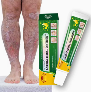 IT Funziona bene per le riprese di eczema lieve, le irritazioni locali e la <span class=keywords><strong>desquamazione</strong></span> secca causate da cambiamenti climatici o dalla sensibilità della pelle. - Product Image 3