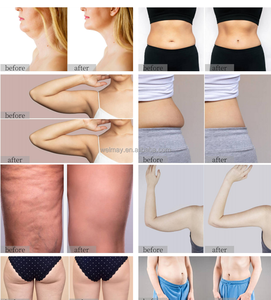 <strong>Vacuum</strong> Cavitation System Roller Massager Butt Lifting Ultrasonic Cavitation System <strong>Vacuum</strong> Roller Sculpting Cavitation Machine - Product Image 5