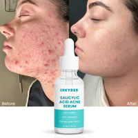 Sérum anti-acné pour le visage, niacinamide, acide salicylique organique, pour les pores, les taches brunes, la réduction des rides, améliore la texture de la peau
