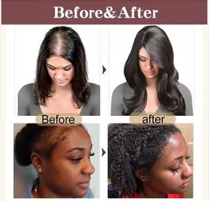 Minyak rambut Batana organik Premium Formula 2 dalam 1 untuk memperkuat pertumbuhan rambut - Product Image 2