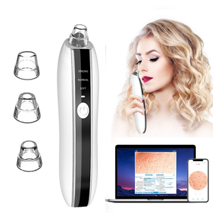 Extracteur de Comédons et d'Acné Électrique Visuel HD <span class=keywords><strong>pour</strong></span> le Visage, Nettoyeur de Pores Indolore, Aspirateur de Points Noirs <span class=keywords><strong>pour</strong></span> Soin Facial - Product Image 2