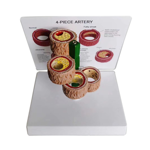 Medical Science Anatomy Artery Blood Vessel Medicine Pathology Thrombus teaching Model - Product Image 2