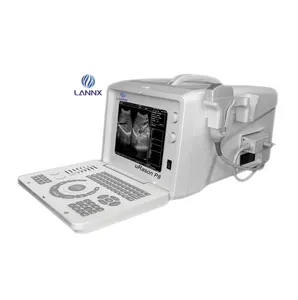 LANNX uRason P8工厂价格数字超声诊断成像系统超声扫描仪ecografo超声设备