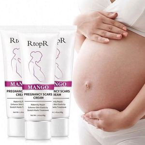 RtopR品牌芒果乳液有效治疗妊娠纹和妊娠疤痕身体皮肤护理霜 - Product Image 1