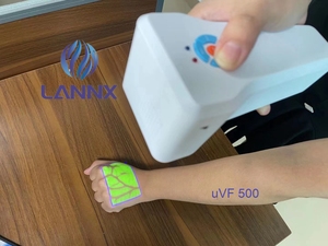 LANNX uVF 500 clinique hôpital Portable dispositif de localisation de vaisseau sanguin médical portable Ir viseur de veines Portable - Product Image 3