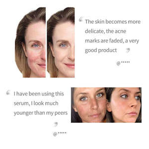 Soin de la peau en marque privée, VC Niacinamide Acide hyaluronique pour hydrater, lutter contre le vieillissement cutané, sérum à la vitamine C lissant - Product Image 3