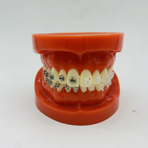患者のデモンストレーションと説明のための4つのタイプのブラケット歯列矯正モデル - Product Image 6