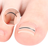 Patch de Correction des Ongles Incarnés en Alliage de Nitinol TPE, Bande Redresseuse pour Ongles de Pied, Plusieurs Tailles, Autocollant de Soin des Ongles à Domicile pour Usage Quotidien