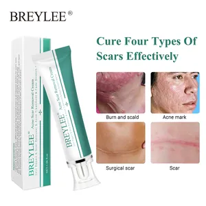 BREYLEE मुँहासे निशान हटाने क्रीम 30g चेहरा क्रीम त्वचा की मरम्मत त्वचा की देखभाल के निशान मुँहासे उपचार हटाने खिंचाव के निशान Whitening क्रीम