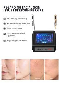 2024 the Latest All-in-one Efficient Acne <strong>Exfoliating</strong> Home <strong>Facial</strong> Care Beauty <strong>Tool</strong> - Product Image 5