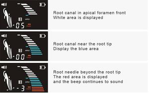 Kualitas Tinggi Gigi Endo Akar Kanal Apex Locator 4,5lcd Penyekrap Lipat Endodontik Mrasure Dokter Gigi Instrumentument - Product Image 4