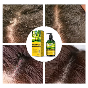 <span class=keywords><strong>Shampoo</strong></span> Unisex Liquido 495ml a Marchio Privato, Formula Organica Vegetale, Controllo Oleosità, Riparazione Capelli, Lisciante, Rimozione Forfora, Trattamento <span class=keywords><strong>Cuoio</strong></span> <span class=keywords><strong>Capelluto</strong></span> - Product Image 2