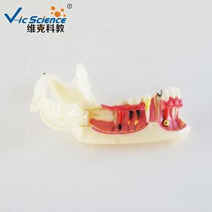 Modelo Dental Anatómico de Dientes Posteriores Inferiores Derechos en Resina y PVC para Educación en Ciencias Médicas en Escuelas y Hospitales - Product Image 3