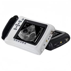 Échographe vétérinaire portable 80311, appareil de diagnostic corporel complet rechargeable, certifié CE - Product Image 3