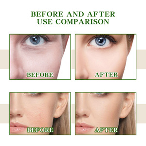 Fábrica Vitamina C Esencia facial Hidratante Embellecedor Tono DE LA PIEL Antiarrugas Reafirmante Suero reparador de líneas finas - Product Image 3
