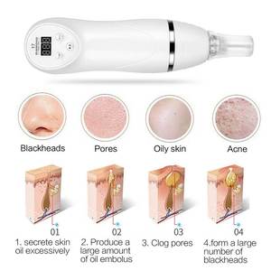 Dispositivo de Belleza para Limpieza Facial de Poros, Exfoliante de Piel, Mini Máquina Digital de Succión al Vacío para Eliminar Puntos Negros con Punta de Diamante - Product Image 2
