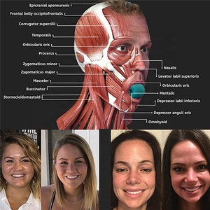 mandíbula Facial ejercicio masticar cara de la herramienta Fitness ejercitador de mandíbula pelota de <span class=keywords><strong>ejercicios</strong></span> de la mandíbula - Product Image 4
