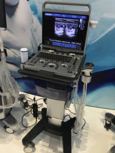 <span class=keywords><strong>Chison</strong></span> Ebit50 Instruments à ultrasons médicaux portables 4d, <span class=keywords><strong>Machine</strong></span> à ultrasons - Product Image 6