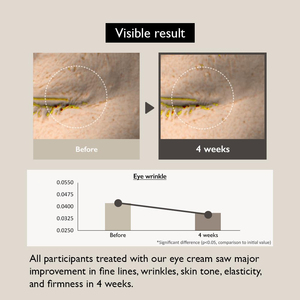 Natürliche Schwarze Reis-Bakuchiol Augencreme Private Label Anti-Aging Falten Feine Linien Augenringe Entferner Straffende Augencreme Hersteller - Product Image 3