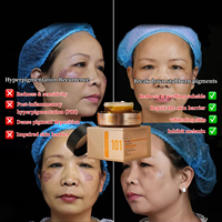 Réducteur de Hyperpigmentation Post-Inflammatoire et de Réflux Cutané pour une Peau Éclatante – Soin Visage