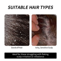 Shampo Anti-Ketombe Penghalus Penyegar Selenium Sulfide Menenangkan Kulit Kepala Anti-Gatal Kualitas Salon Formula 2-in-1 Grosir