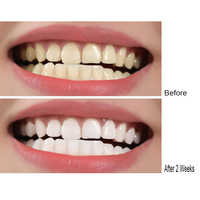GlorySmile - Gel Blanqueador Dental Profesional Certificado por la CE, en Jeringa, Blanqueamiento Rápido con Soporte para Logotipo Privado