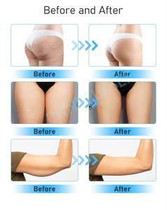 Ganzkörper massage 8G Hochfrequenz-Vibrations massage Entsperren Sie die Meridiane und entspannen Sie die Muskeln - Product Image 3