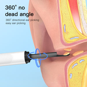 B5 통합 USB 유선 의료용 안전 귀지 제거 도구 카메라 전동 귀 청소 이경 - Product Image 5