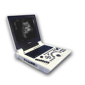 Échographe vétérinaire 3D 4D portable avec écran HD pour cliniques et hôpitaux – Fournisseur médical - Product Image 5