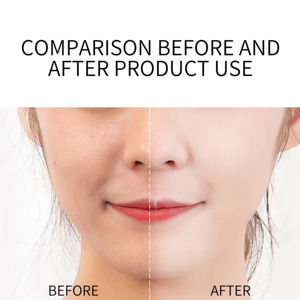 Private Label Dark Spot <b>Serum</b> Whitening Skin Care Products Face Anti Wrinkle <b>Vitamin</b> C <b>Serum</b> - Product Image 6